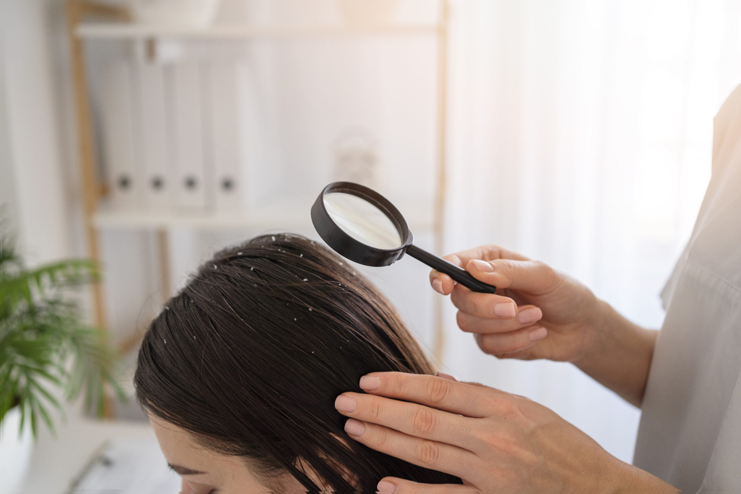 How to Get Rid of Dandruff with Ayurveda: Effective Natural Remedies for a Healthy Scalp